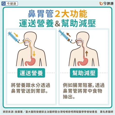 鼻胃管反抽顏色代表意義|臺北榮民總醫院鳳林分院 鼻胃管異常之觀察及照護